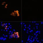 Myc Tag Antibody in Immunocytochemistry (ICC/IF)