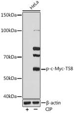 Phospho-c-Myc (Thr58) Antibody in Western Blot (WB)