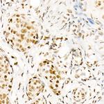 Phospho-POLR2A (Ser5) Antibody in Immunohistochemistry (Paraffin) (IHC (P))