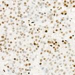 Phospho-POLR2A (Ser5) Antibody in Immunohistochemistry (Paraffin) (IHC (P))