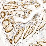 Phospho-POLR2A (Ser5) Antibody in Immunohistochemistry (Paraffin) (IHC (P))