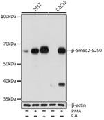 Phospho-SMAD2 (Ser250) Antibody in Western Blot (WB)