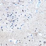 Phospho-Tau (Ser396) Antibody in Immunohistochemistry (Paraffin) (IHC (P))