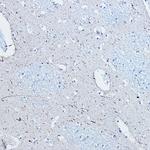 Phospho-Tau (Ser396) Antibody in Immunohistochemistry (Paraffin) (IHC (P))