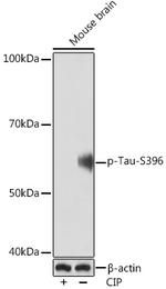 Phospho-Tau (Ser396) Antibody in Western Blot (WB)