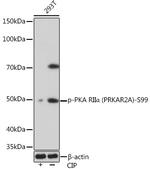 Phospho-PRKAR2A (Ser99) Antibody in Western Blot (WB)