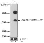 Phospho-PRKAR2A (Ser99) Antibody in Western Blot (WB)