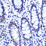 Phospho-SMC1 (Ser957) Antibody in Immunohistochemistry (Paraffin) (IHC (P))