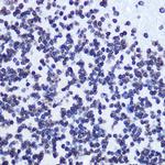 Phospho-SMC1 (Ser957) Antibody in Immunohistochemistry (Paraffin) (IHC (P))