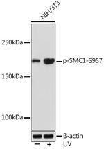 Phospho-SMC1 (Ser957) Antibody in Western Blot (WB)