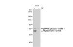 Phospho-Zap-70 (Tyr319, Tyr352) Antibody in Western Blot (WB)