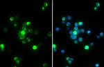 Phospho-Zap-70 (Tyr319, Tyr352) Antibody in Immunocytochemistry (ICC/IF)