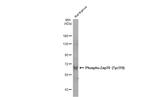 Phospho-Zap-70 (Tyr319, Tyr352) Antibody in Western Blot (WB)