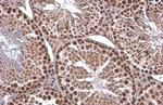 EED Antibody in Immunohistochemistry (Paraffin) (IHC (P))