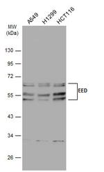 EED Antibody in Western Blot (WB)