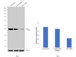 beta Dystroglycan Antibody in Western Blot (WB)