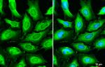 beta Dystroglycan Antibody in Immunocytochemistry (ICC/IF)