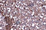 beta Dystroglycan Antibody in Immunohistochemistry (Paraffin) (IHC (P))