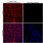 Bcl-2 Antibody in Immunohistochemistry (Paraffin) (IHC (P))