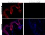 Cytokeratin 14 Antibody in Immunohistochemistry (Paraffin) (IHC (P))