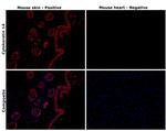 Cytokeratin 14 Antibody in Immunohistochemistry (Paraffin) (IHC (P))