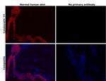 Cytokeratin 14 Antibody in Immunohistochemistry (Paraffin) (IHC (P))