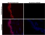 Cytokeratin 14 Antibody in Immunohistochemistry (Paraffin) (IHC (P))