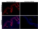 Cytokeratin 14 Antibody in Immunohistochemistry (Paraffin) (IHC (P))