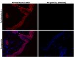 Cytokeratin 14 Antibody in Immunohistochemistry (Paraffin) (IHC (P))