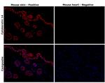 Cytokeratin 14 Antibody in Immunohistochemistry (Paraffin) (IHC (P))