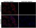 Cytokeratin 14 Antibody in Immunohistochemistry (Paraffin) (IHC (P))