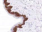 Cytokeratin 14 Antibody in Immunohistochemistry (Paraffin) (IHC (P))