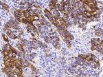 Cytokeratin 14 Antibody in Immunohistochemistry (Paraffin) (IHC (P))