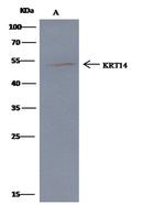 Cytokeratin 14 Antibody in Immunoprecipitation (IP)