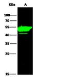 Cytokeratin 14 Antibody in Western Blot (WB)