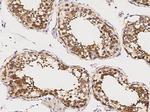 GDF3 Antibody in Immunohistochemistry (Paraffin) (IHC (P))