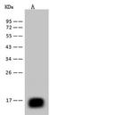 REG3B Antibody in Western Blot (WB)