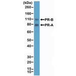 Progesterone Receptor Antibody in Western Blot (WB)