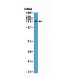 CPS1 Antibody in Western Blot (WB)