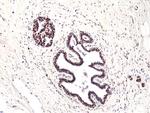 FOXP1 Antibody in Immunohistochemistry (Paraffin) (IHC (P))