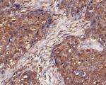 DFNA5 Antibody in Immunohistochemistry (Paraffin) (IHC (P))