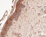 DFNA5 Antibody in Immunohistochemistry (Paraffin) (IHC (P))