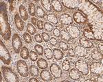 Aspartate Aminotransferase, Cytoplasmic Antibody in Immunohistochemistry (Paraffin) (IHC (P))