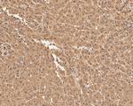 Aspartate Aminotransferase, Cytoplasmic Antibody in Immunohistochemistry (Paraffin) (IHC (P))