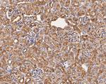 Aspartate Aminotransferase, Cytoplasmic Antibody in Immunohistochemistry (Paraffin) (IHC (P))