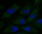 alpha Actinin Antibody in Immunocytochemistry (ICC/IF)