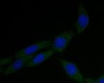 alpha Actinin Antibody in Immunocytochemistry (ICC/IF)