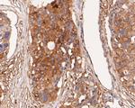 alpha Actinin Antibody in Immunohistochemistry (Paraffin) (IHC (P))