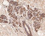 alpha Actinin Antibody in Immunohistochemistry (Paraffin) (IHC (P))