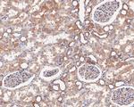 alpha Actinin Antibody in Immunohistochemistry (Paraffin) (IHC (P))